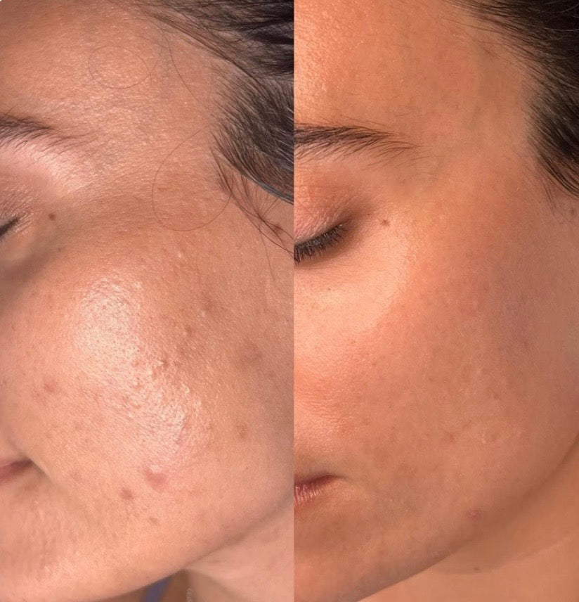 <h2>Elles/Ils parlent a notre place : </h2>