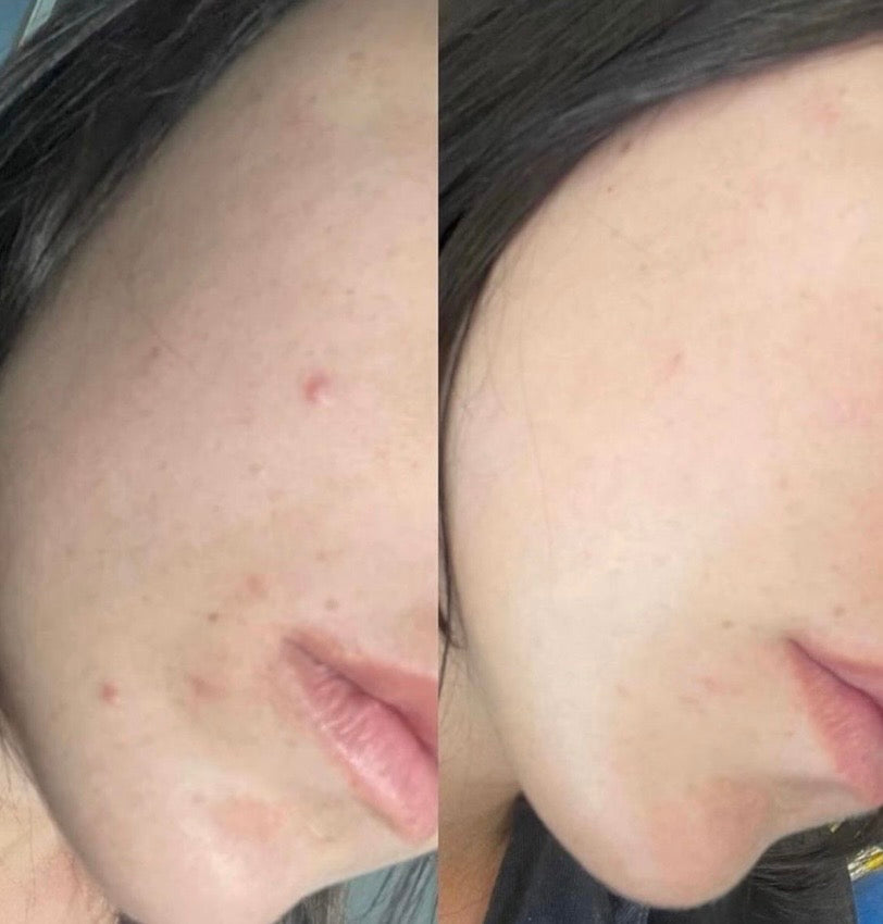 <h2>Elles/Ils parlent a notre place : </h2>