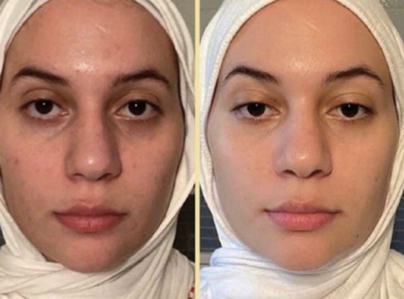 <h2>Elles/Ils parlent a notre place : </h2>